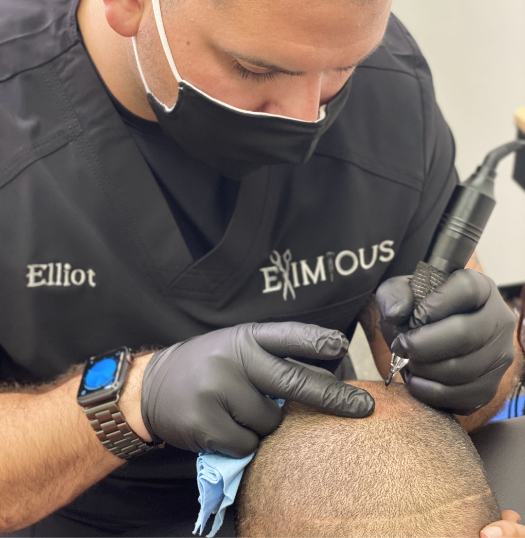 filling in a thinning spot using scalp micropigmentation services